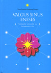 Valgus sinus eneses. Sisemise selguse ja tasakaalu tee